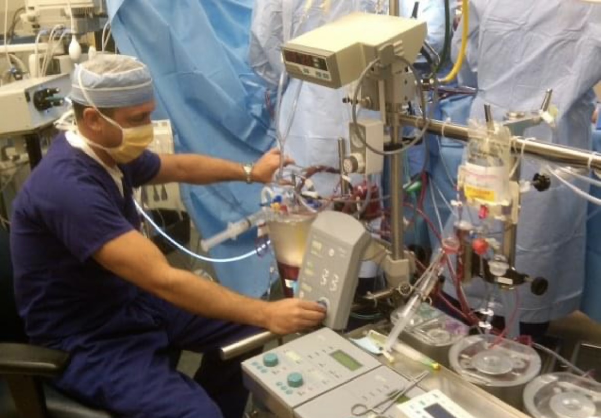 perfusionist staffing