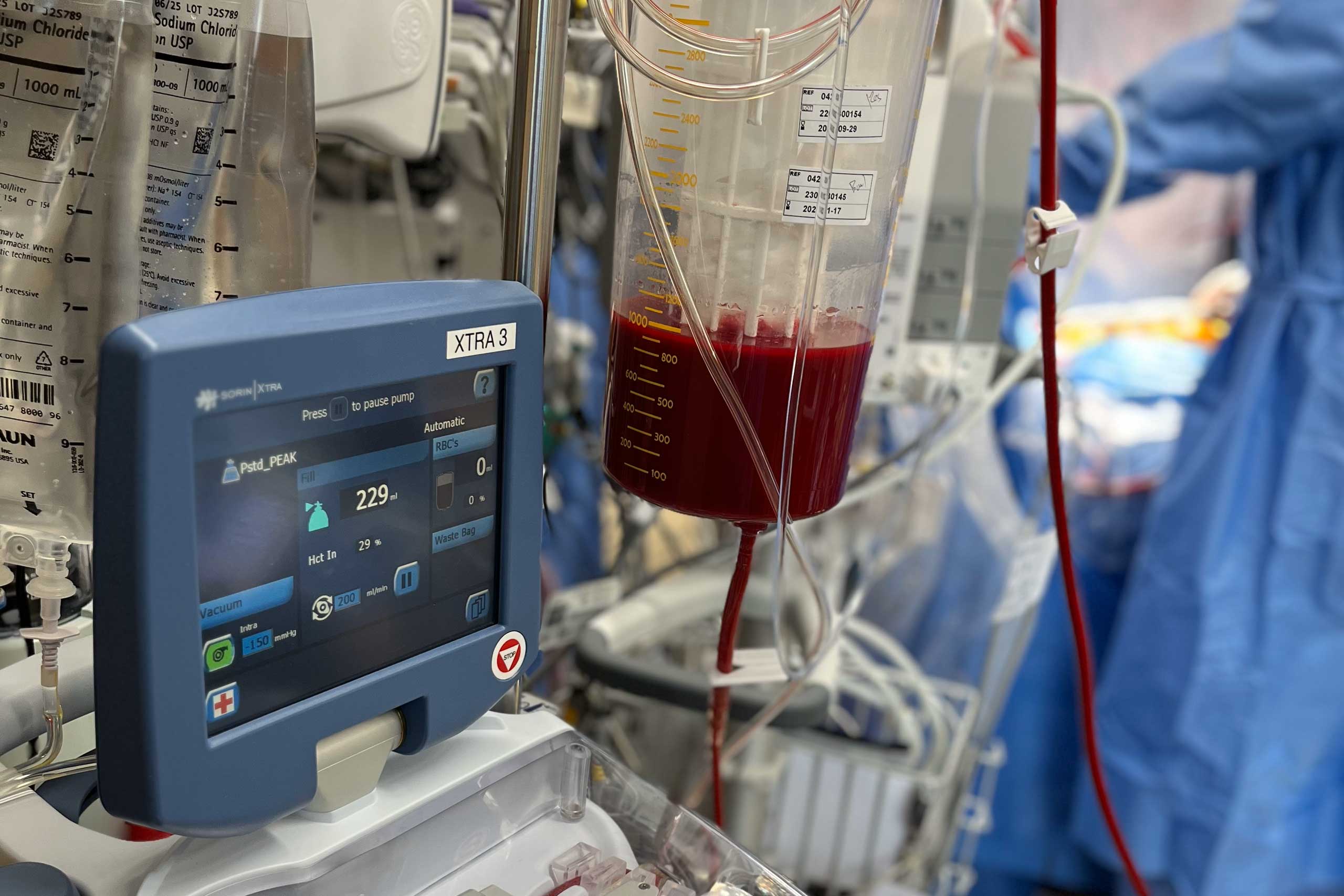 Blood Management